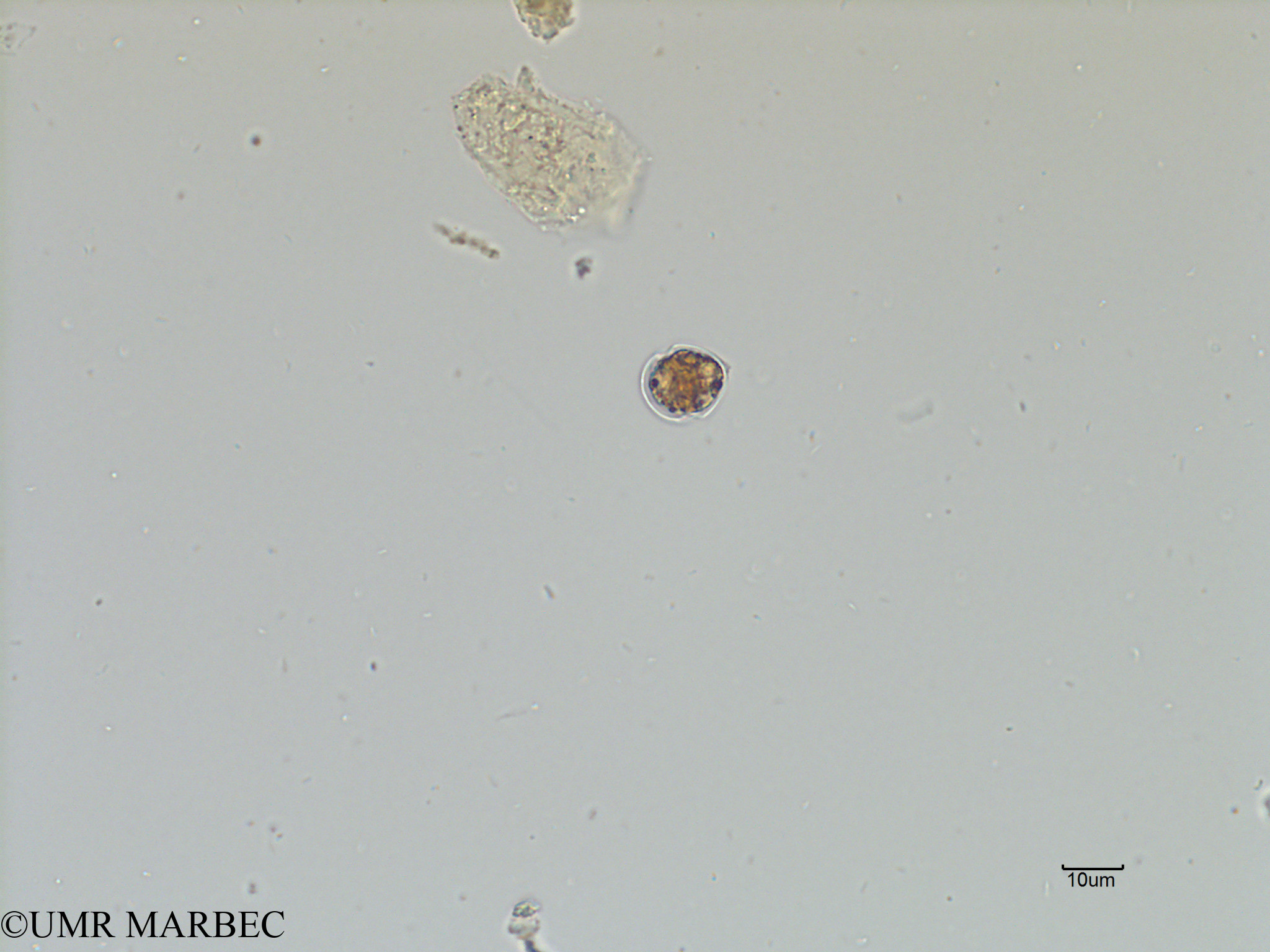 phyto/Scattered_Islands/iles_glorieuses/SIREME November 2015/Scrippsiella spp (SIREME-Glorieuses2015-ech1-171116-Scrippsiella-5)(copy).jpg